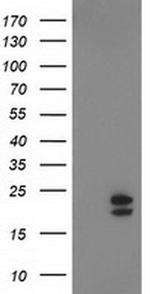 NDUFB9 Antibody in Western Blot (WB)