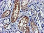 LACTB2 Antibody in Immunohistochemistry (Paraffin) (IHC (P))