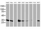 LACTB2 Antibody in Western Blot (WB)