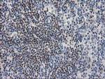 ARFGAP1 Antibody in Immunohistochemistry (Paraffin) (IHC (P))