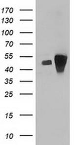 ARFGAP1 Antibody in Western Blot (WB)