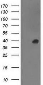 ANKRD53 Antibody in Western Blot (WB)