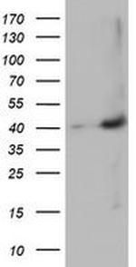 MAGEB18 Antibody in Western Blot (WB)