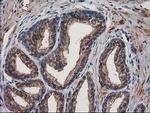 Destrin Antibody in Immunohistochemistry (Paraffin) (IHC (P))