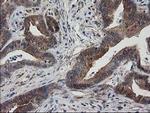 Destrin Antibody in Immunohistochemistry (Paraffin) (IHC (P))