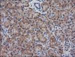 Destrin Antibody in Immunohistochemistry (Paraffin) (IHC (P))