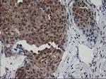 Destrin Antibody in Immunohistochemistry (Paraffin) (IHC (P))