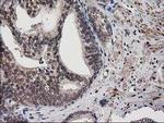 Destrin Antibody in Immunohistochemistry (Paraffin) (IHC (P))