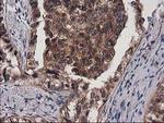 Destrin Antibody in Immunohistochemistry (Paraffin) (IHC (P))