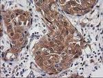 Destrin Antibody in Immunohistochemistry (Paraffin) (IHC (P))