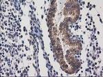 Destrin Antibody in Immunohistochemistry (Paraffin) (IHC (P))