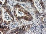 SULT1C2 Antibody in Immunohistochemistry (Paraffin) (IHC (P))