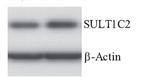 SULT1C2 Antibody in Western Blot (WB)