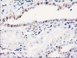 ITM2B Monoclonal Antibody (OTI1C11)