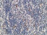 PRKAR1B Antibody in Immunohistochemistry (Paraffin) (IHC (P))