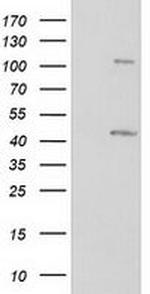 PRKAR1B Antibody in Western Blot (WB)