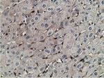 RBP1 Antibody in Immunohistochemistry (Paraffin) (IHC (P))