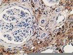 Alcohol Dehydrogenase 1B Antibody in Immunohistochemistry (Paraffin) (IHC (P))