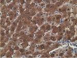 Alcohol Dehydrogenase 1B Antibody in Immunohistochemistry (Paraffin) (IHC (P))