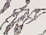 Alcohol Dehydrogenase 1B Antibody in Immunohistochemistry (Paraffin) (IHC (P))
