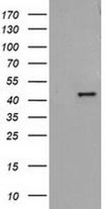 Alcohol Dehydrogenase 1B Antibody in Western Blot (WB)
