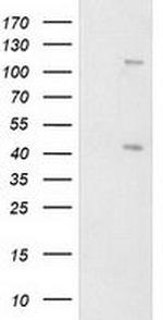 PRKAR1B Antibody in Western Blot (WB)