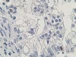 HDHD2 Antibody in Immunohistochemistry (Paraffin) (IHC (P))