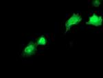 RBP1 Monoclonal Antibody (OTI2E1)
