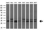 HDHD2 Antibody in Western Blot (WB)