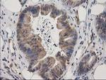 MAPRE2 Antibody in Immunohistochemistry (Paraffin) (IHC (P))