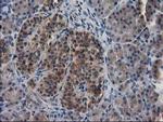 MAPRE2 Antibody in Immunohistochemistry (Paraffin) (IHC (P))