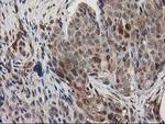 MAPRE2 Antibody in Immunohistochemistry (Paraffin) (IHC (P))