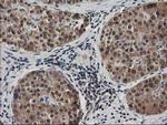 MAPRE2 Antibody in Immunohistochemistry (Paraffin) (IHC (P))