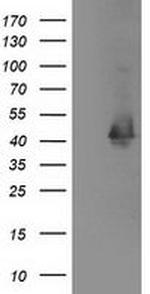 MAPRE2 Antibody in Western Blot (WB)