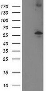 PPM1B Monoclonal Antibody (OTI3E10)