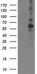 PPM1B Monoclonal Antibody (OTI3F2)