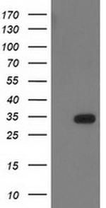 HDHD2 Antibody in Western Blot (WB)