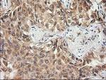MAPRE2 Antibody in Immunohistochemistry (Paraffin) (IHC (P))
