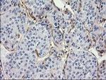MAPRE2 Antibody in Immunohistochemistry (Paraffin) (IHC (P))