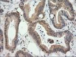 MAPRE2 Antibody in Immunohistochemistry (Paraffin) (IHC (P))