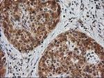 MAPRE2 Antibody in Immunohistochemistry (Paraffin) (IHC (P))