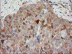 MAPRE2 Antibody in Immunohistochemistry (Paraffin) (IHC (P))