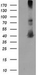 MAPRE2 Antibody in Western Blot (WB)