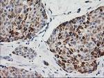 Adenylate Kinase 4 Antibody in Immunohistochemistry (Paraffin) (IHC (P))
