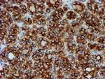 beta-4 Tubulin Antibody in Immunohistochemistry (Paraffin) (IHC (P))
