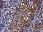 beta-4 Tubulin Antibody in Immunohistochemistry (Paraffin) (IHC (P))