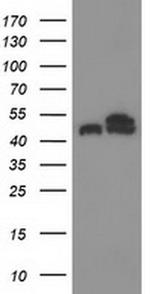 beta-4 Tubulin Antibody in Western Blot (WB)