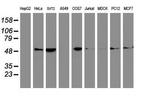 beta-4 Tubulin Antibody in Western Blot (WB)