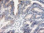 Adenylate Kinase 4 Antibody in Immunohistochemistry (Paraffin) (IHC (P))