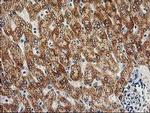 Adenylate Kinase 4 Antibody in Immunohistochemistry (Paraffin) (IHC (P))